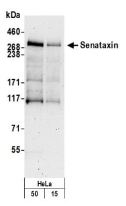 Senataxin Antibody, Novus Biologicals 100 &mu;L | Buy Online | Novus Biologicals | Fisher Scientific